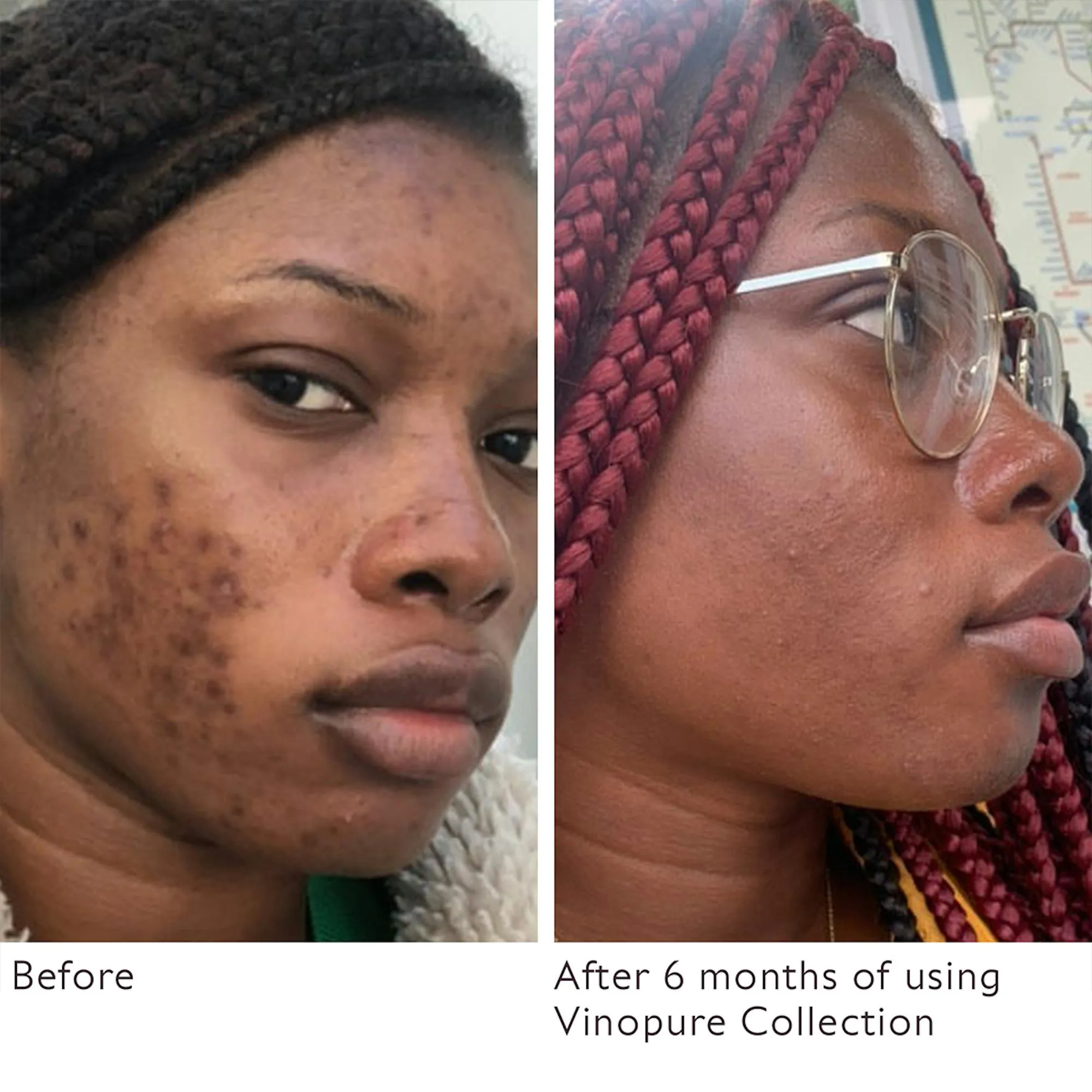 Caudalie Vinopure Pore Purifying Gel Cleanser