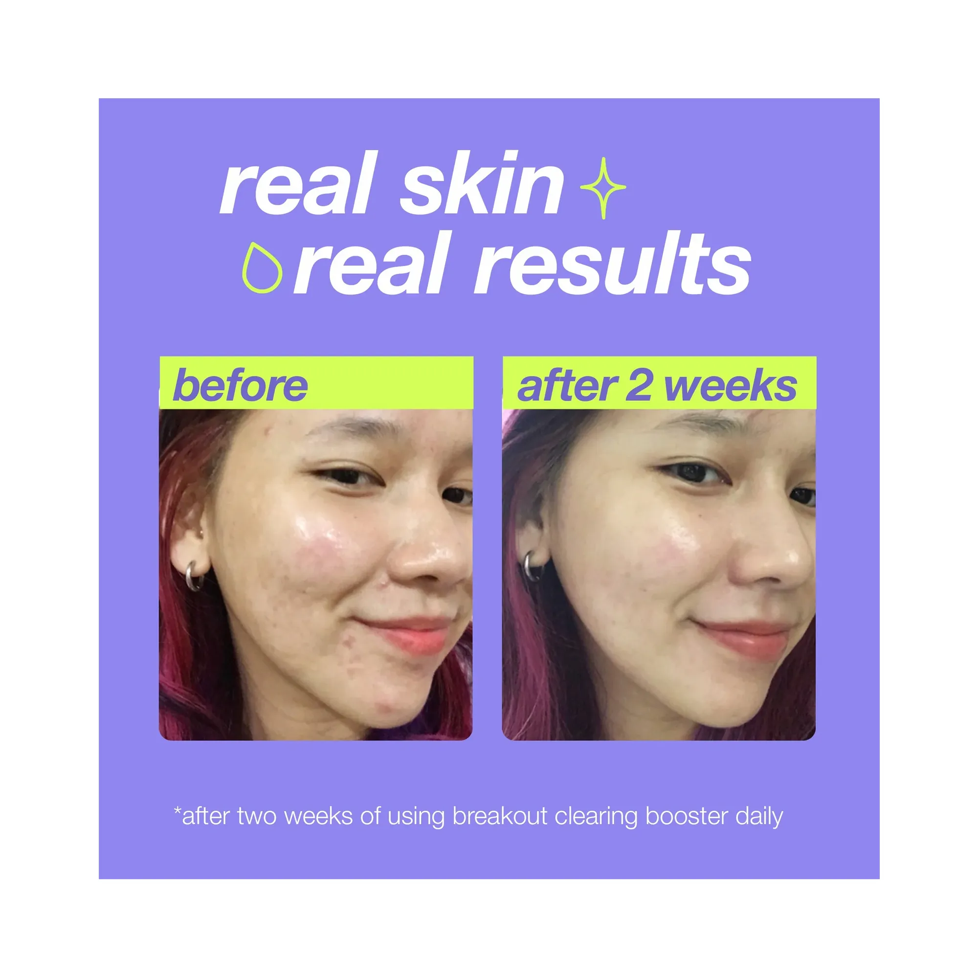 Dermalogica Clear Start Breakout Clearing Booster