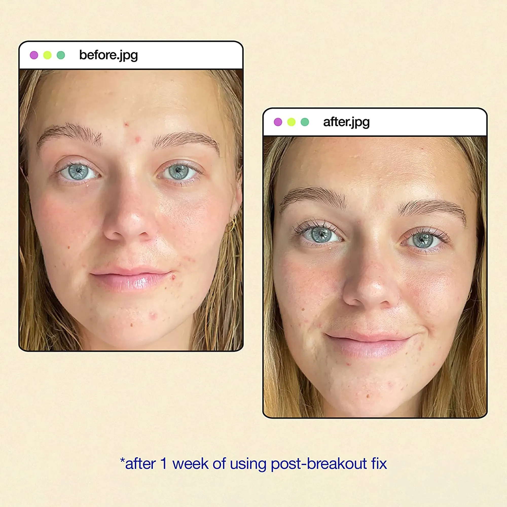 Dermalogica Clear Start Post Breakout Fix
