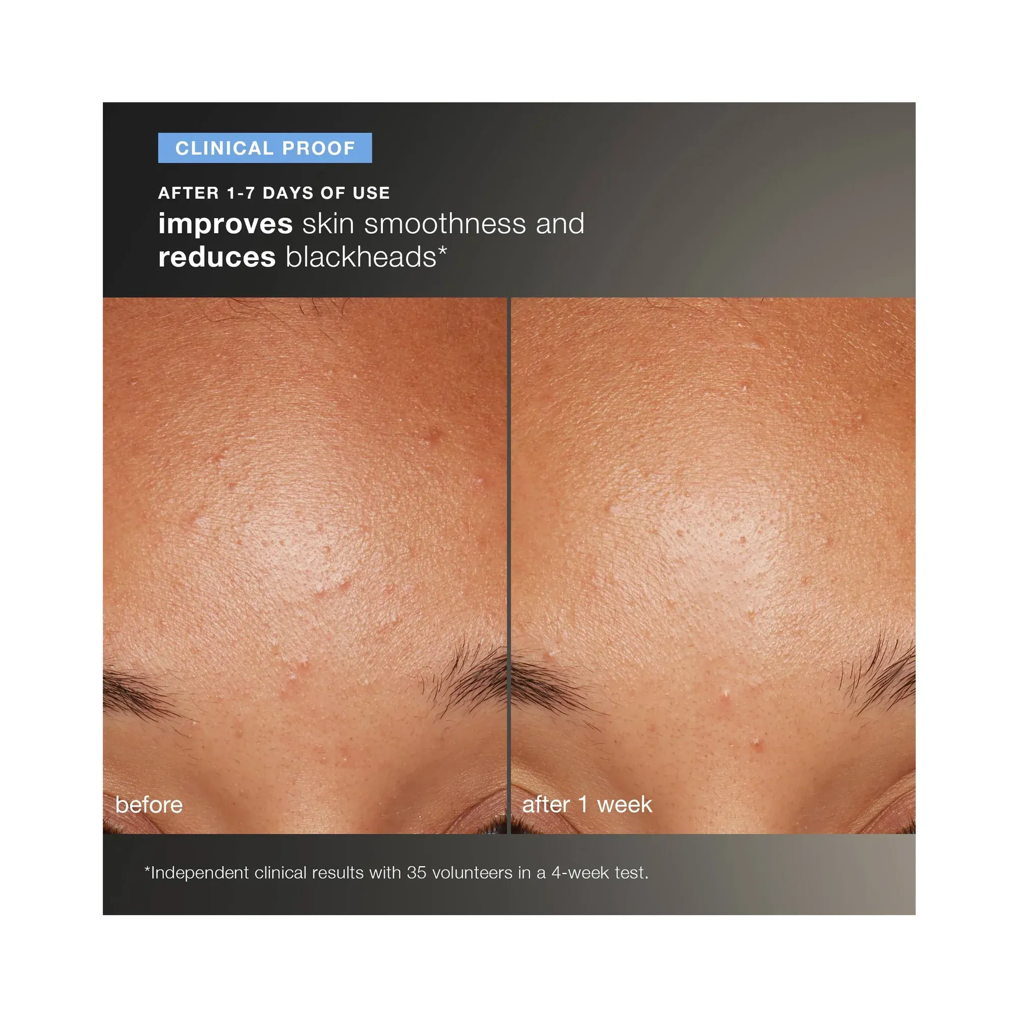 Dermalogica Daily Microfoliant Refill