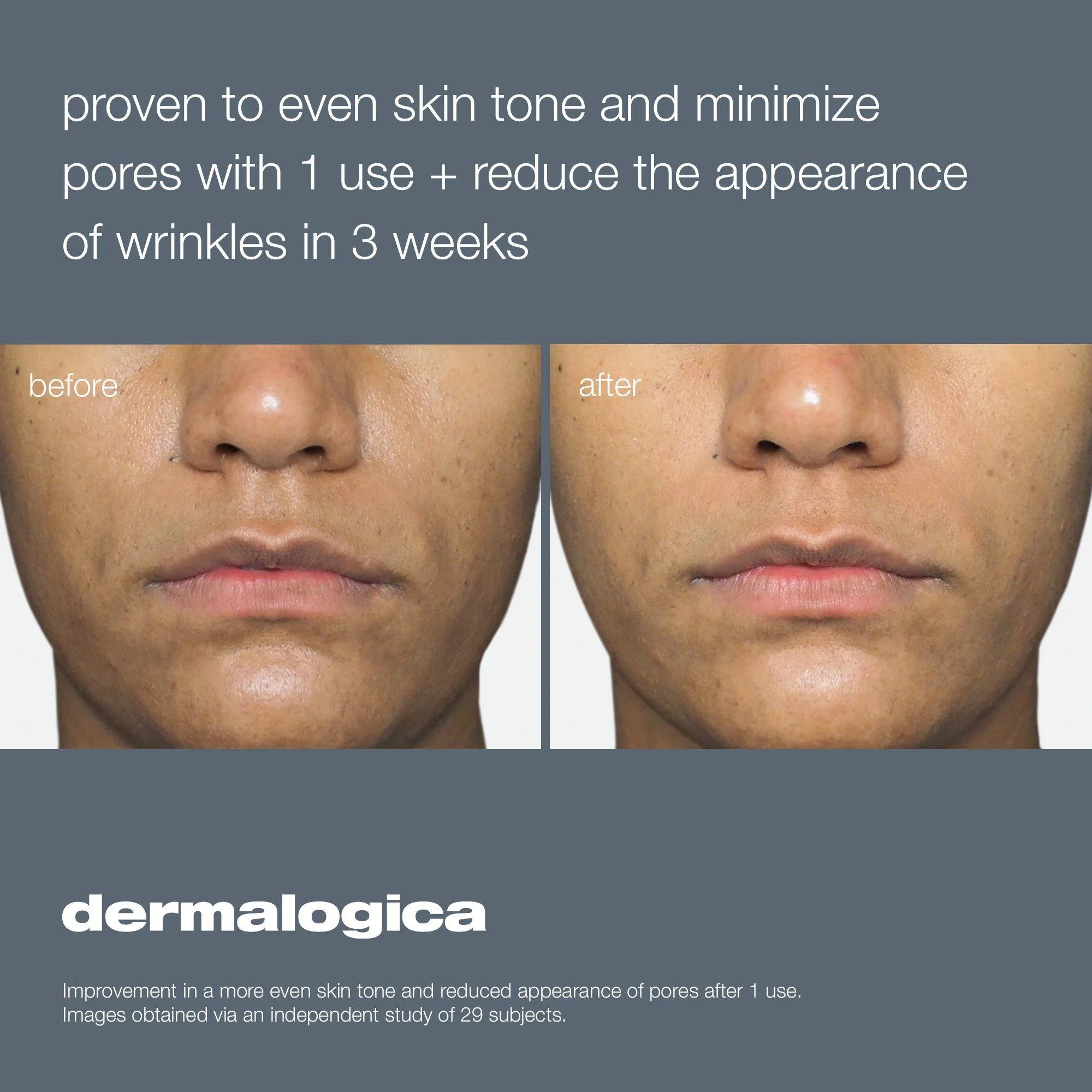 Dermalogica Liquid Peelfoliant