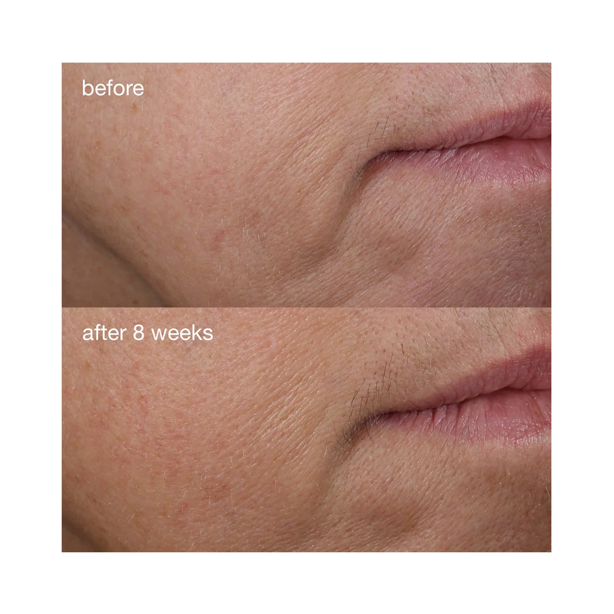 Dermalogica Phyto-Nature Firming Serum
