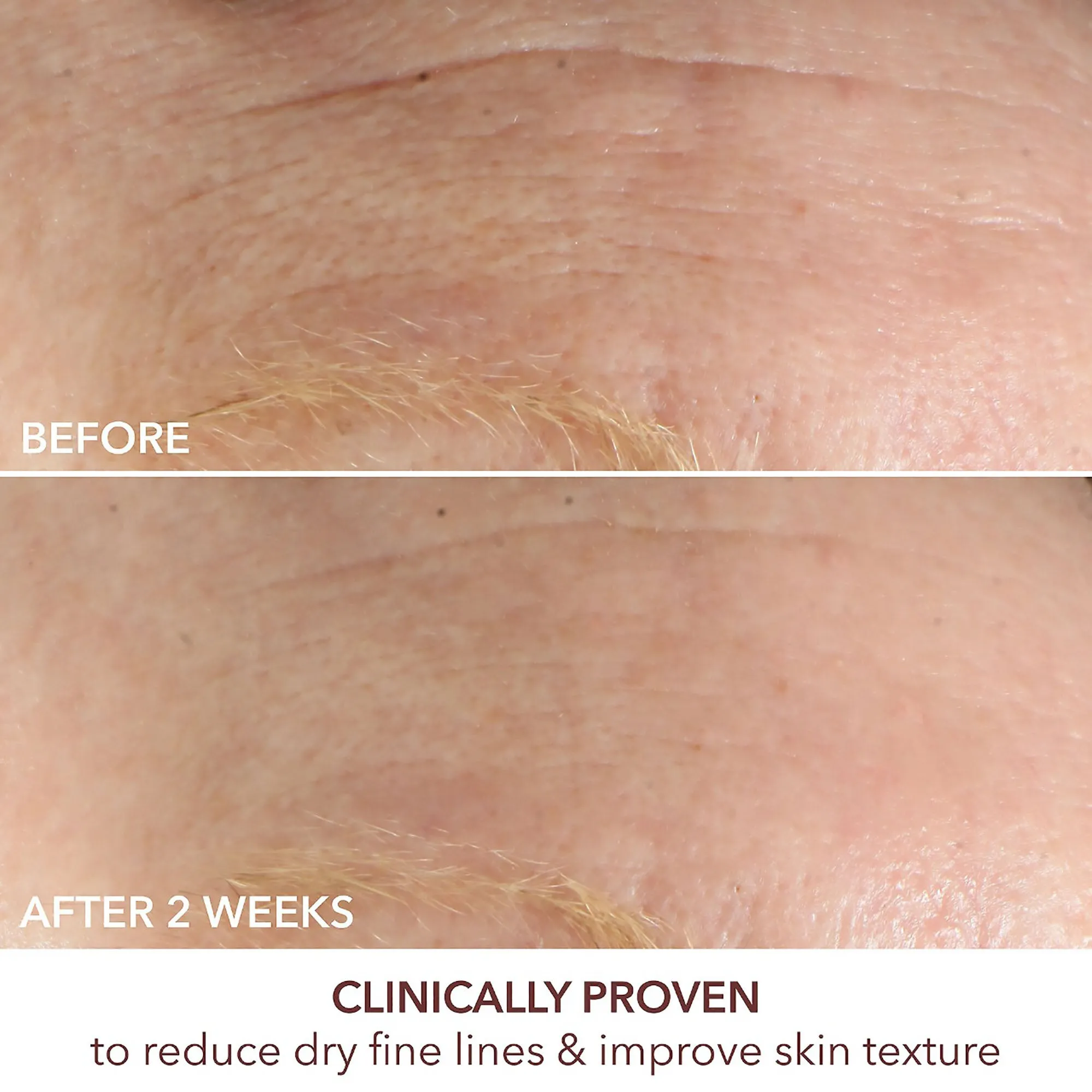 Dr. Dennis Gross Advanced Retinol   Ferulic Intense Wrinkle Cream
