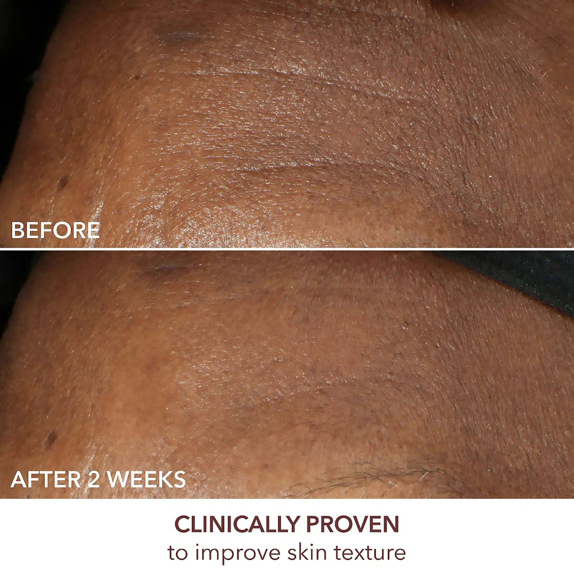 Dr. Dennis Gross Advanced Retinol   Ferulic Intense Wrinkle Cream