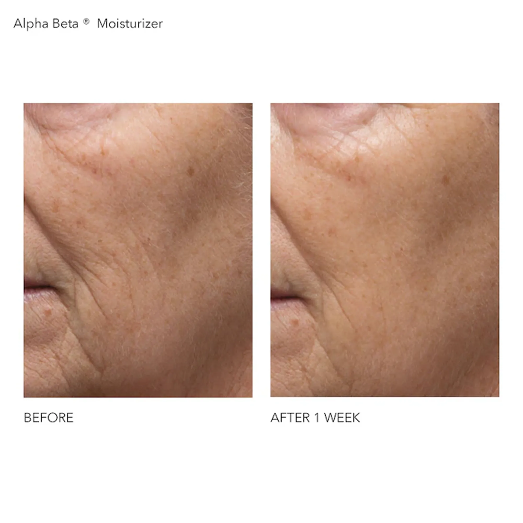 Dr. Dennis Gross Alpha Beta Daily Moisturizer