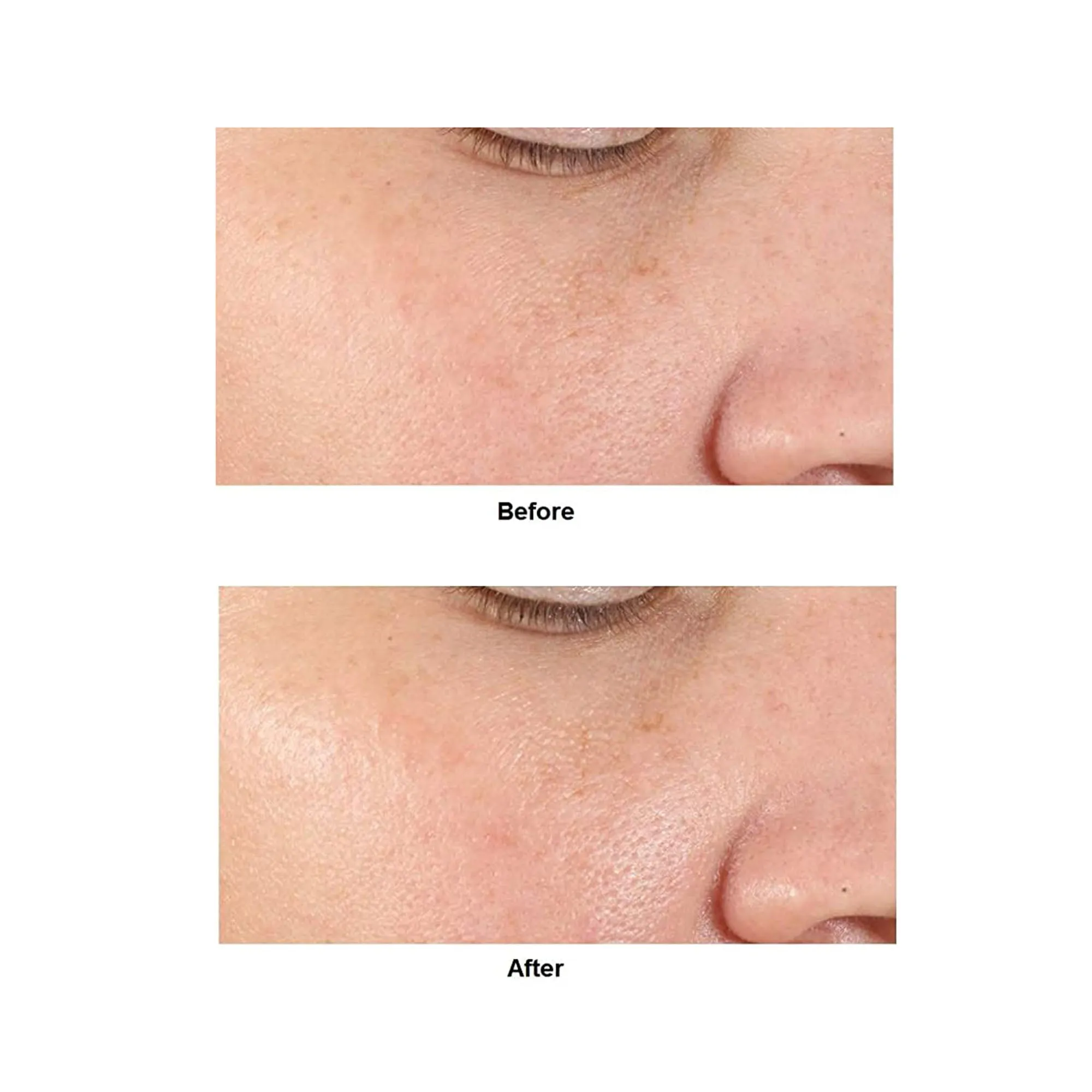 Dr. Dennis Gross Alpha Beta Pore Perfecting & Refining Serum