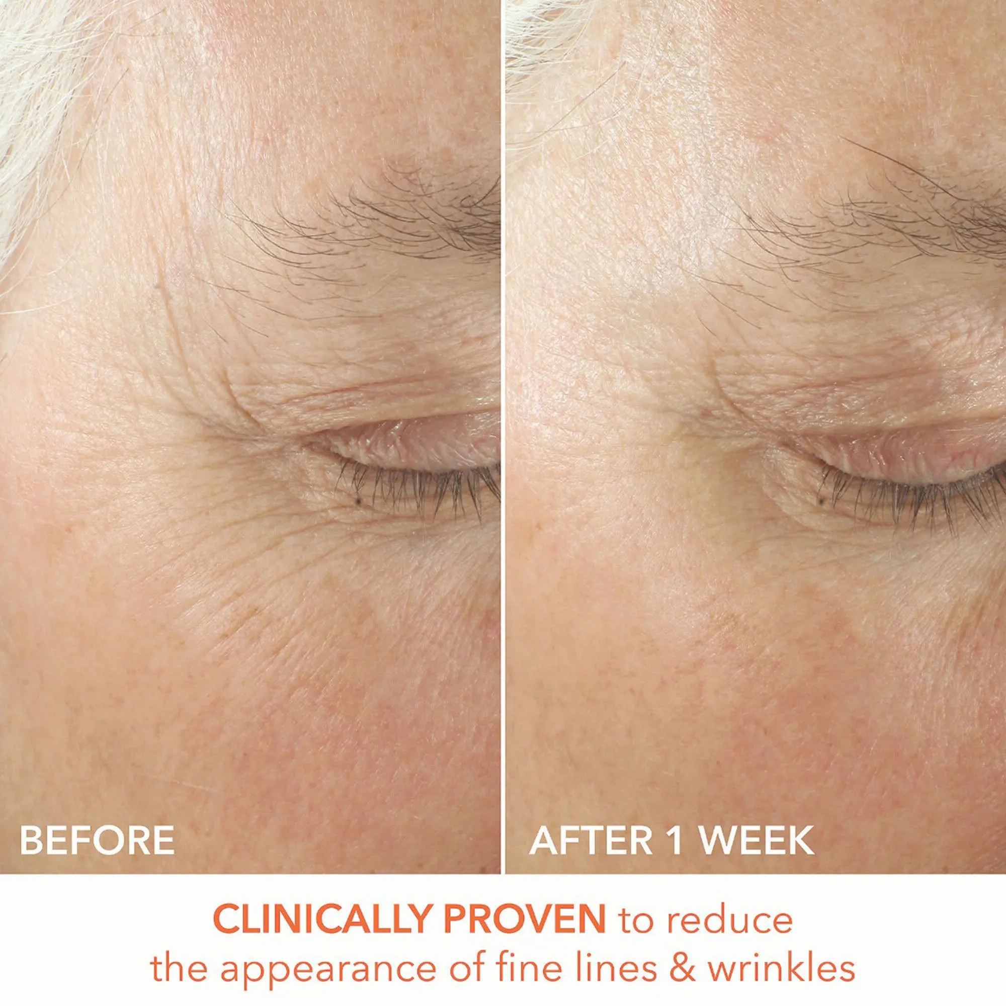 Dr. Dennis Gross Alpha Beta Ultra Gentle Daily Peel - 30 Applications