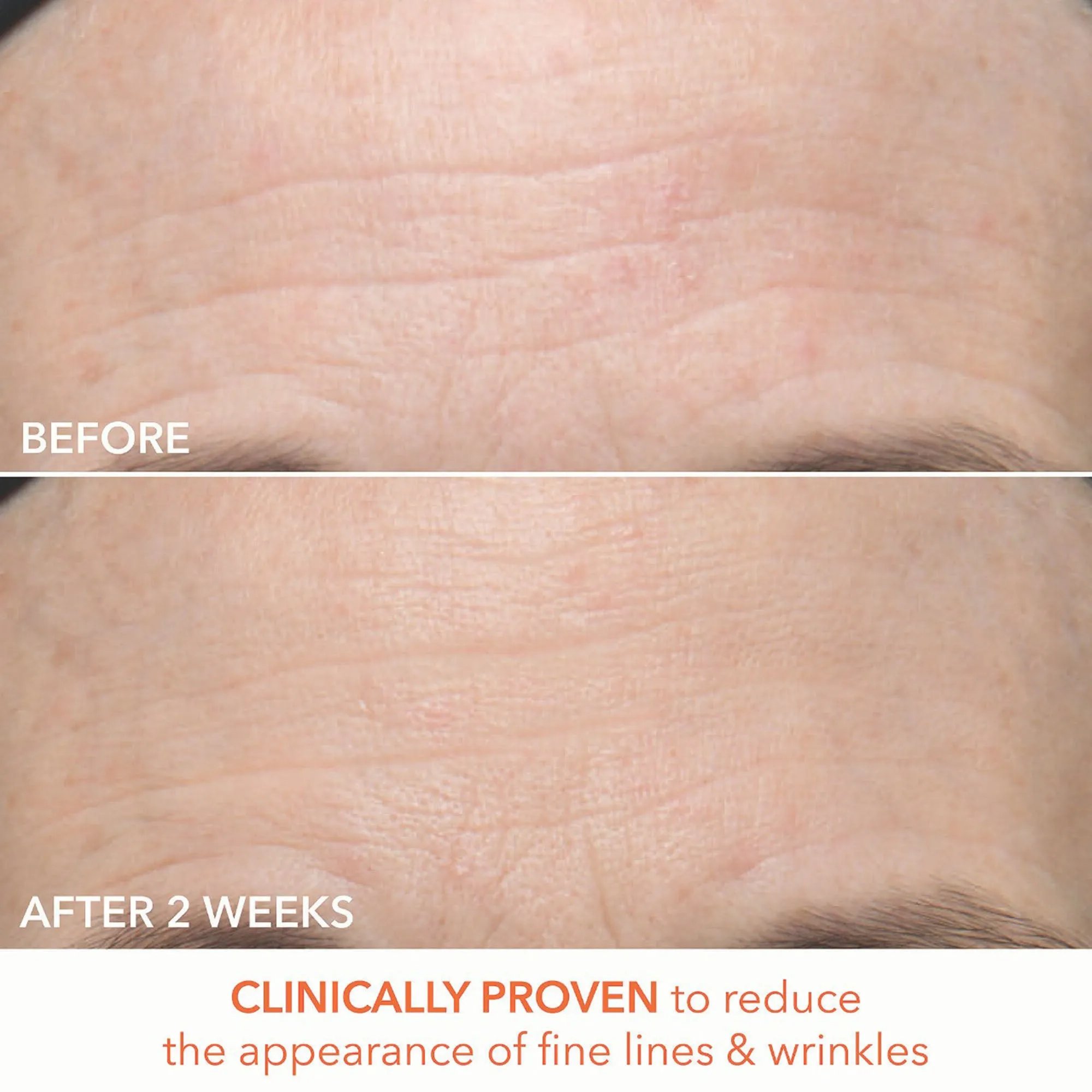 Dr. Dennis Gross Alpha Beta Ultra Gentle Daily Peel - 30 Applications