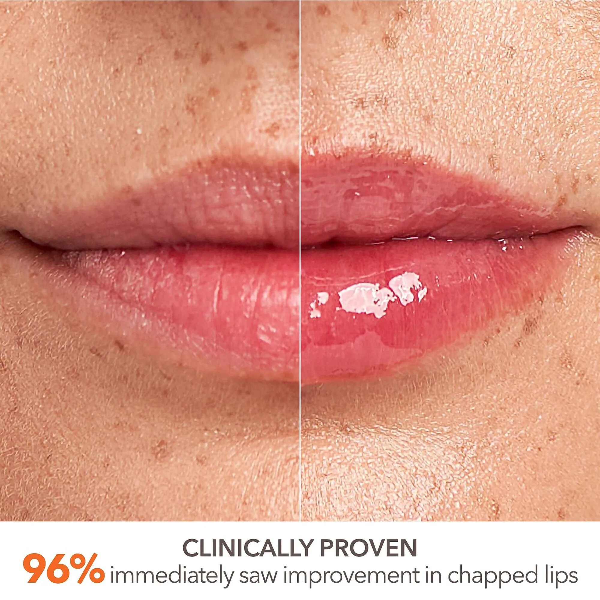 Dr. Dennis Gross DermInfusions Plump   Repair Lip Treatment