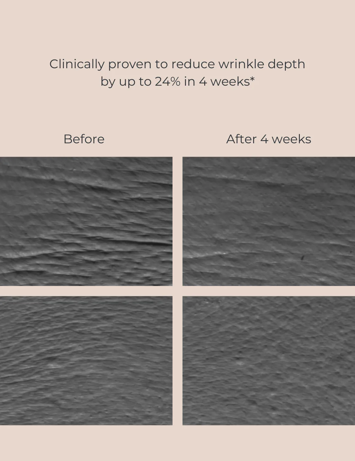 INIKA Organic Bakuchiol Serum Natural Retinol Alternative Inika Organic