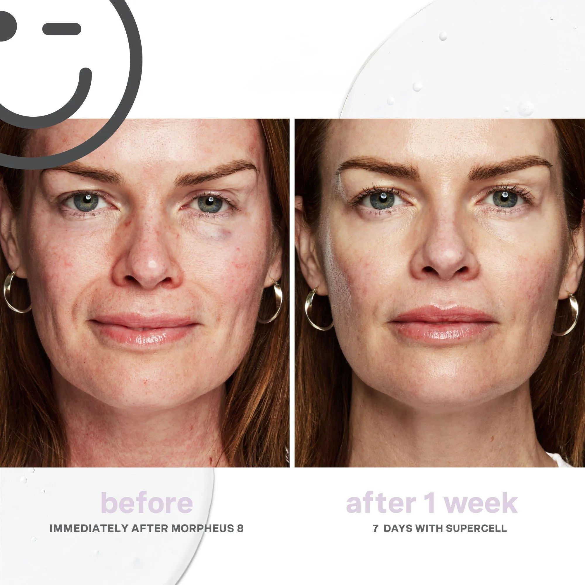 Kate Somerville KateCeuticals SuperCell Rejuvenation Serum
