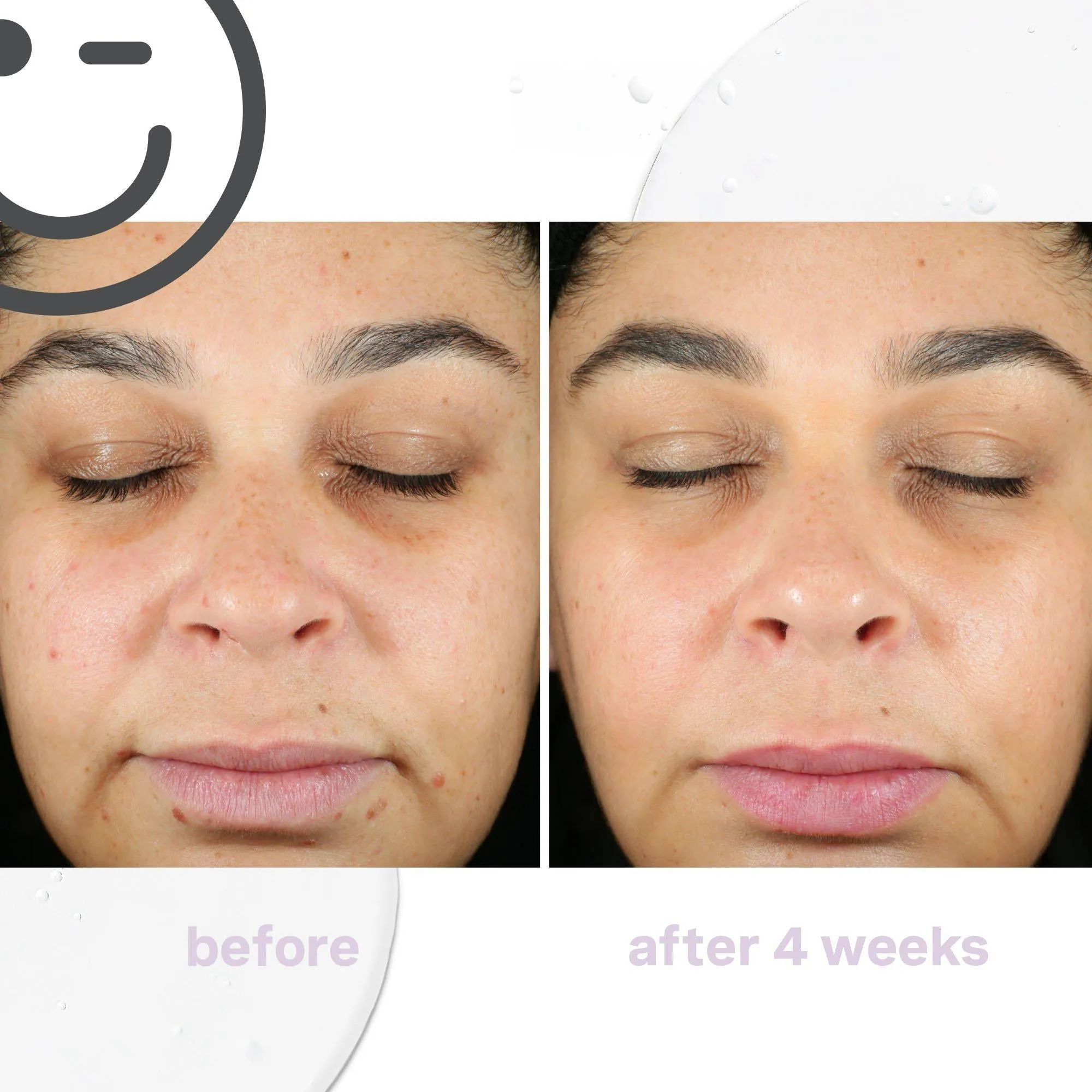 Kate Somerville KateCeuticals SuperCell Rejuvenation Serum