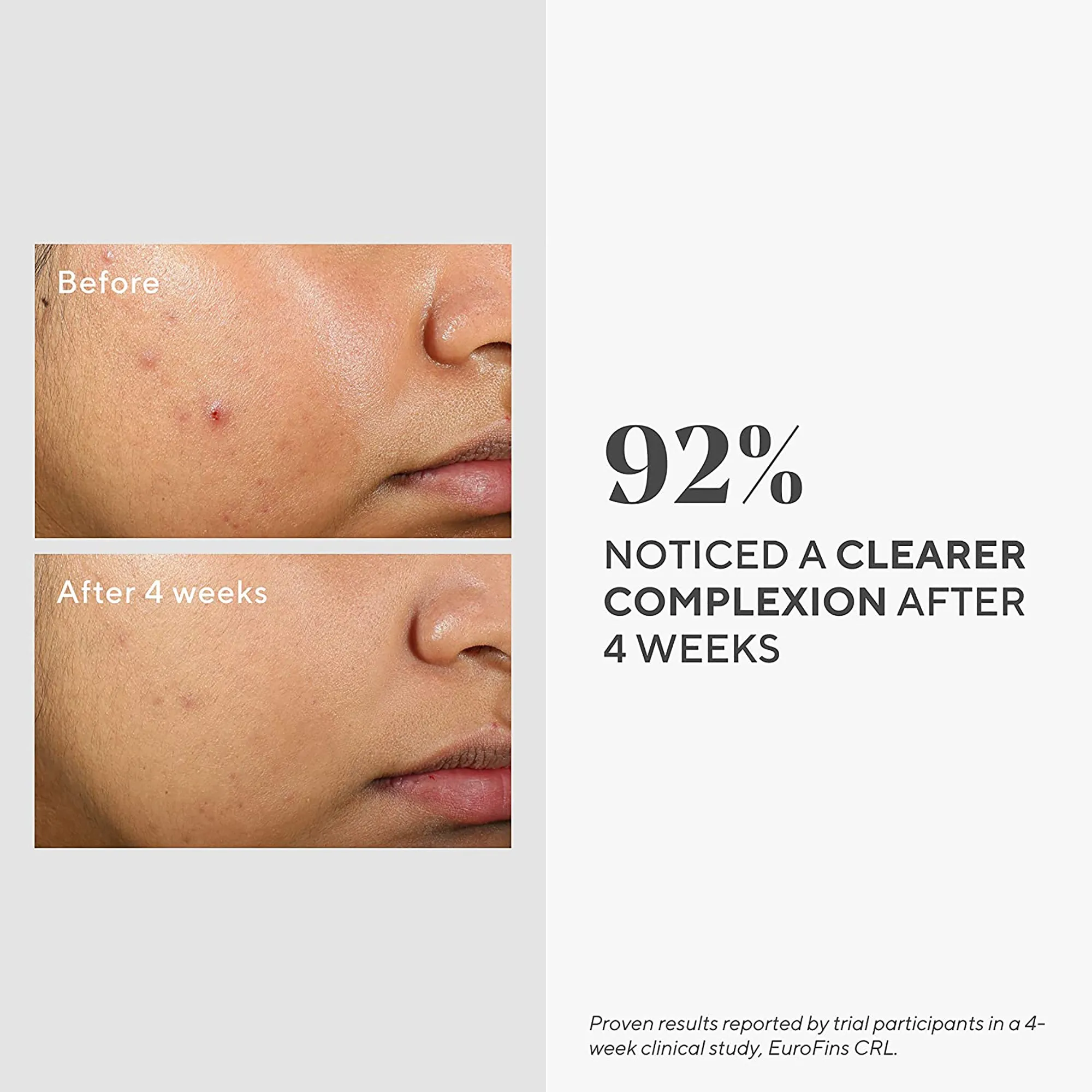 Murad Clarifying Water Gel Moisturizer