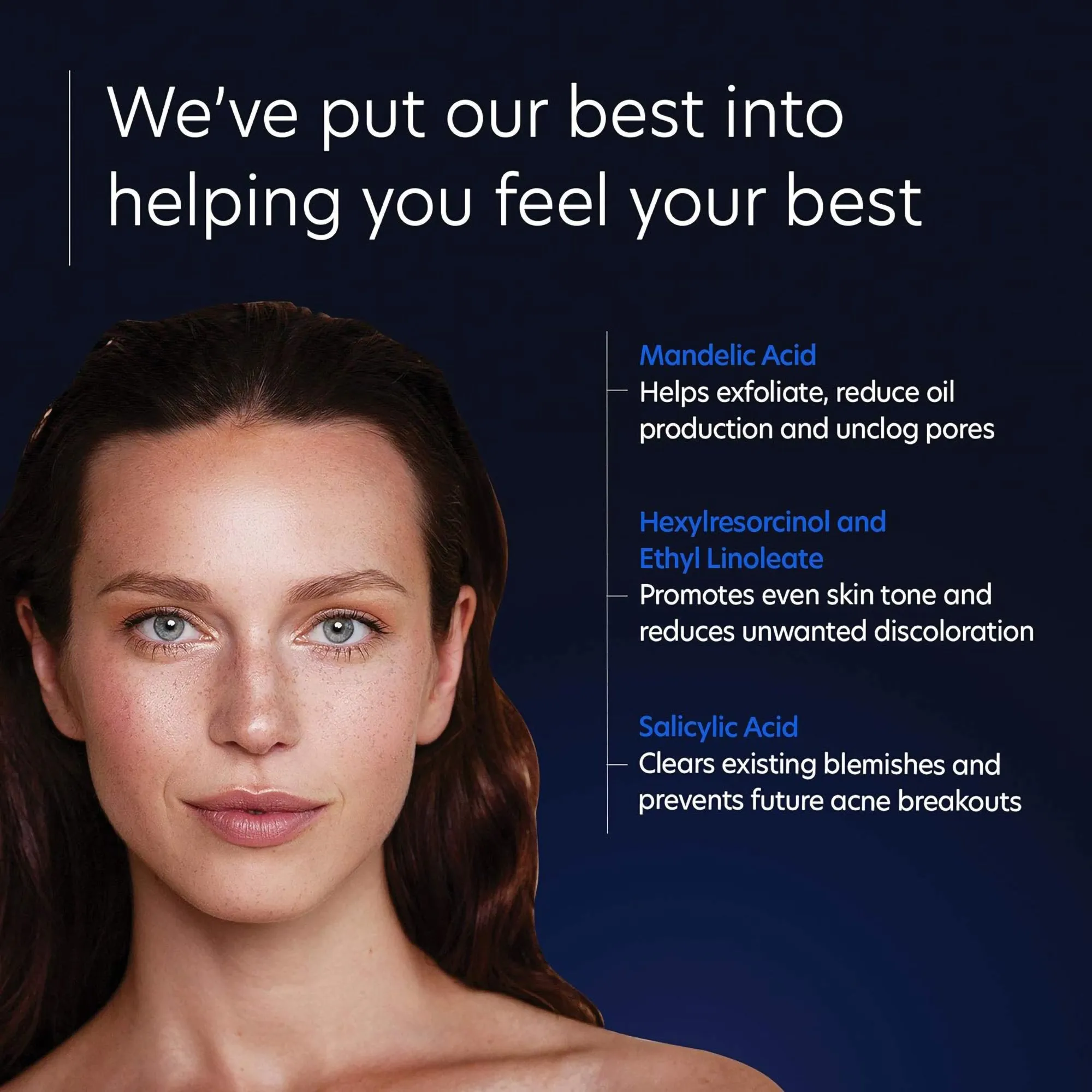 PCA SKIN Acne Gel with Omnisome