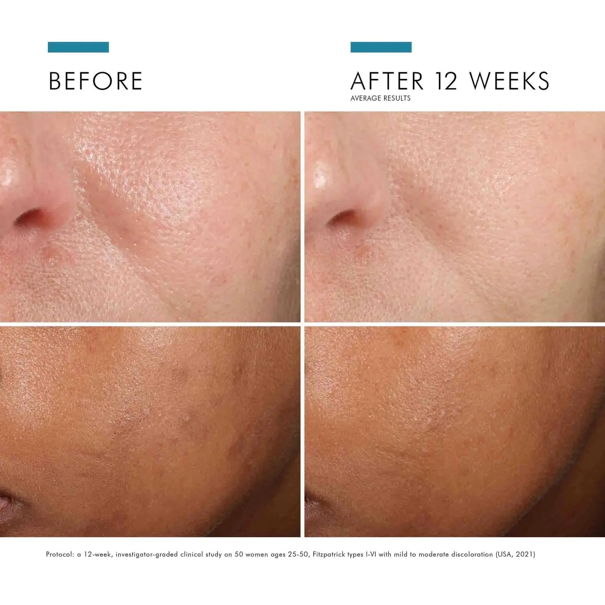 SkinCeuticals Phloretin CF with Ferulic Acid