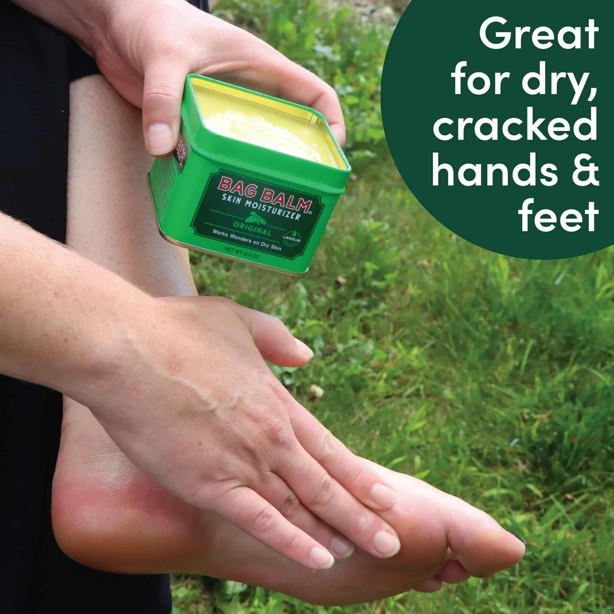 VERMONTS ORIGINAL BAG BALM, SKIN MOISTURIZER FOR DRY SKIN